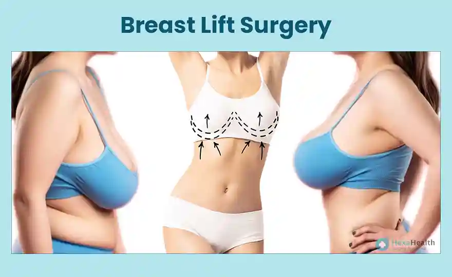 Surgery & Recovery