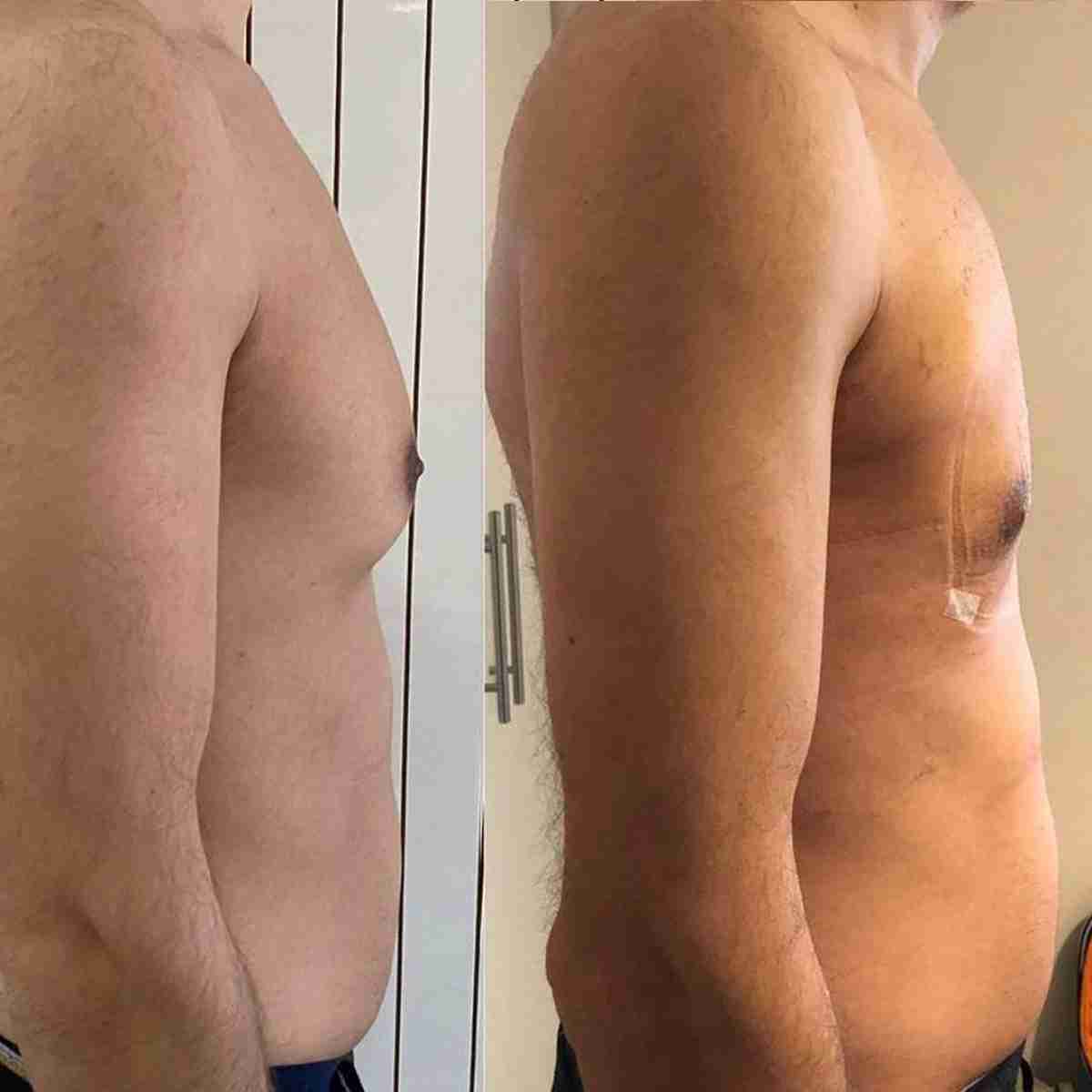 Surgery & Recovery
