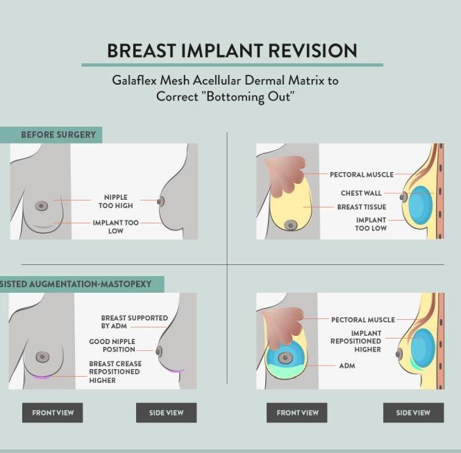 Consultation & Assessment