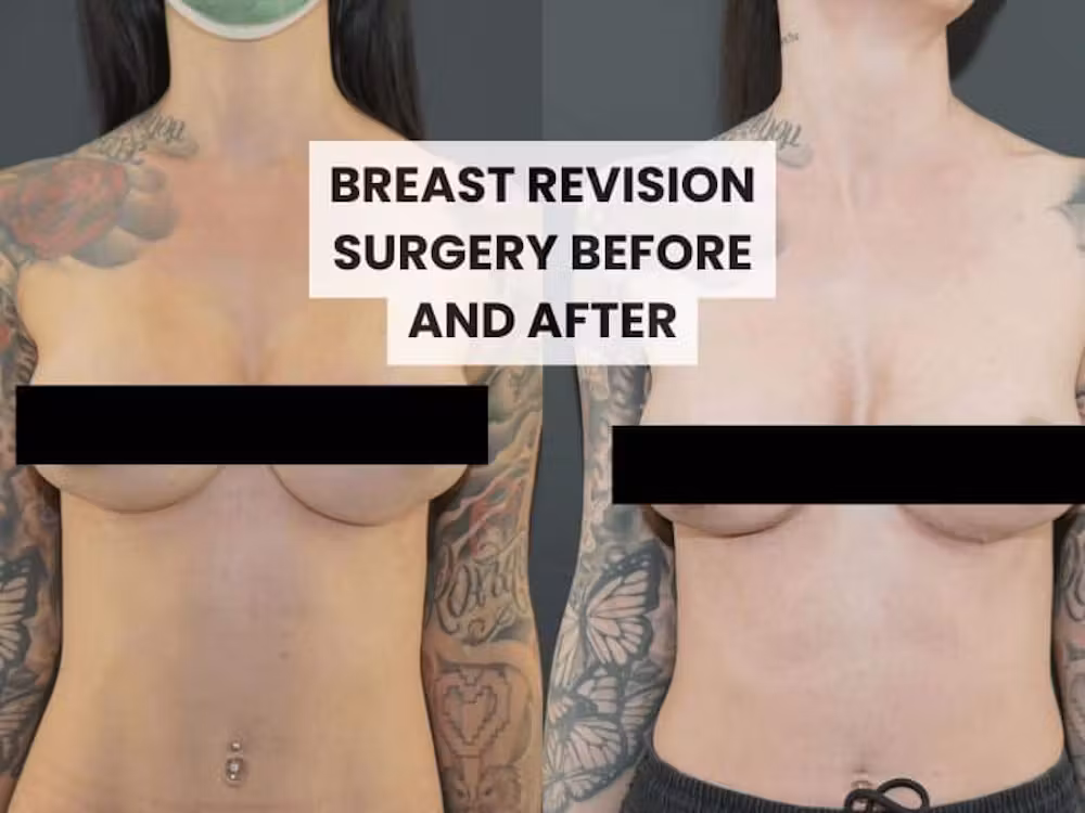 Surgery & Recovery